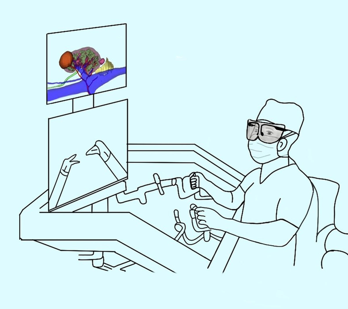 MIM Process Solving Complex Challenges for a U.S. Medical Device Innovator